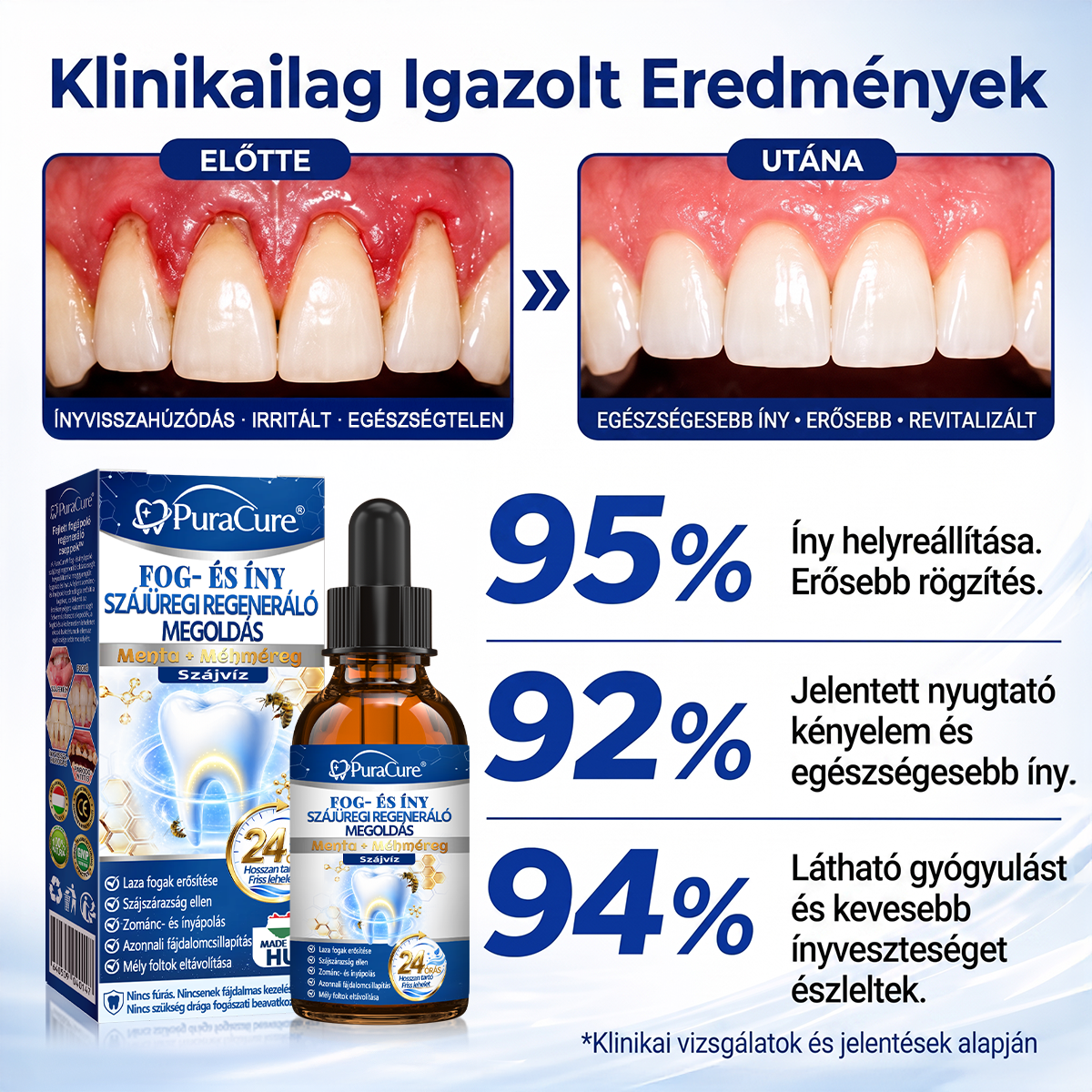🎁 Már csak 5 csomag maradt! Szerezze meg most 50% kedvezménnyel! Ne maradjon le a mai ajánlatról!