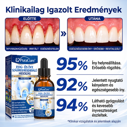 🎁 Már csak 5 csomag maradt! Szerezze meg most 50% kedvezménnyel! Ne maradjon le a mai ajánlatról!