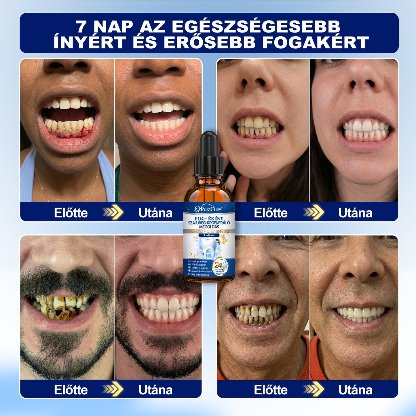 🎁 Már csak 5 csomag maradt! Szerezze meg most 50% kedvezménnyel! Ne maradjon le a mai ajánlatról!
