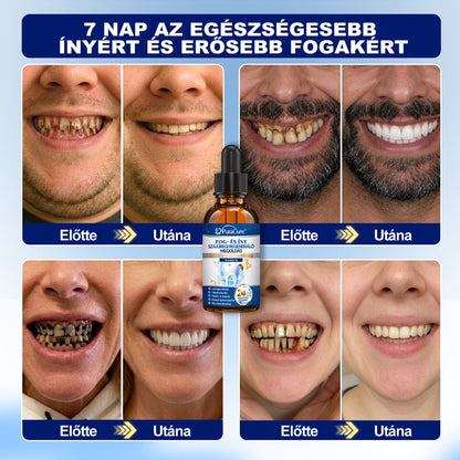 🎁 Már csak 5 csomag maradt! Szerezze meg most 50% kedvezménnyel! Ne maradjon le a mai ajánlatról!