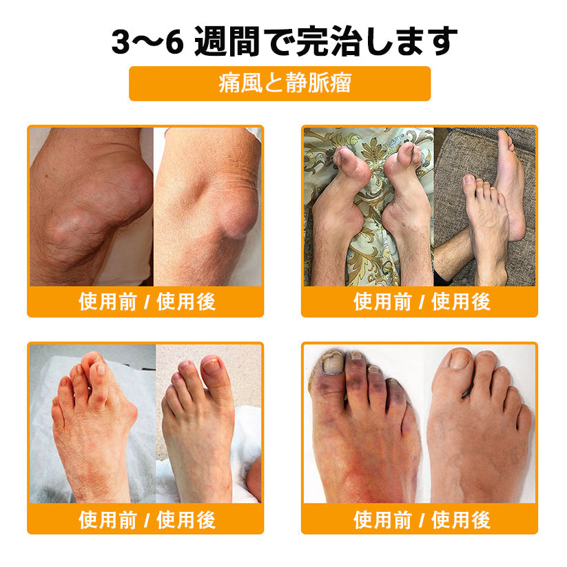 🎁 残り5箱のみ！ 🎉 今ならさらに50％OFF！  健康で元気な毎日を始めるチャンスです。  この機会を逃すと、次回の特別キャンペーンは来年までお待ちいただくことになるかもしれません！