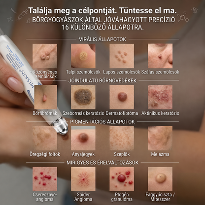 𝐇𝐈𝐒𝐊𝐈𝐍® 7 napos megoldás bőrkinövésekre és foltokra | Fájdalommentes precíziós rollerball, hegek nélkül