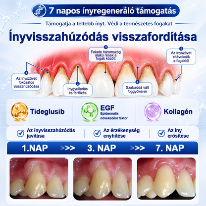 🎁 Már csak 5 csomag maradt! Szerezze meg most 50% kedvezménnyel! Ne maradjon le a mai ajánlatról!
